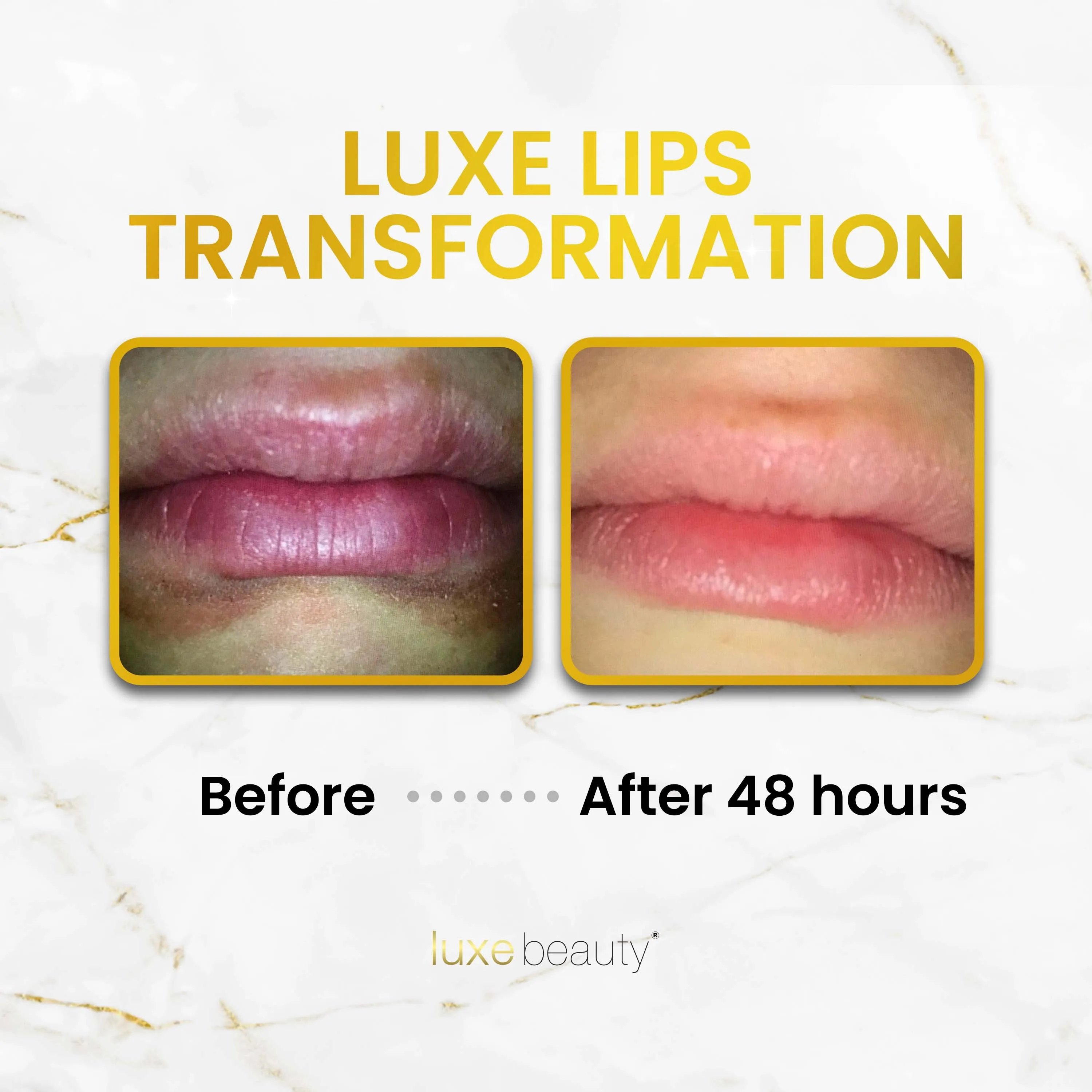Beeswax Free, Nut Free Lip Balm - Luxe Lips - Grapefruit Scent