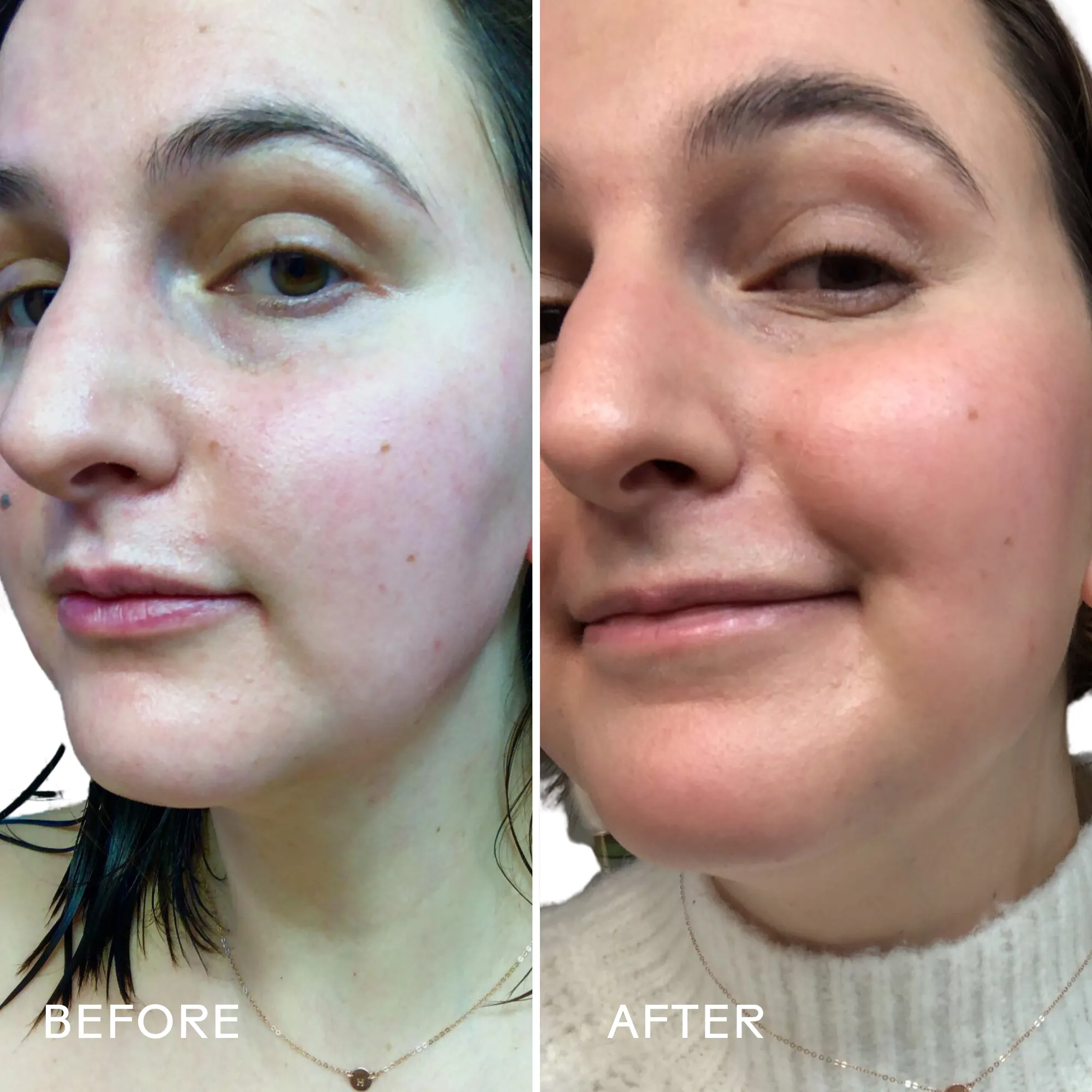 Boost 49% Rosehip Oil Serum