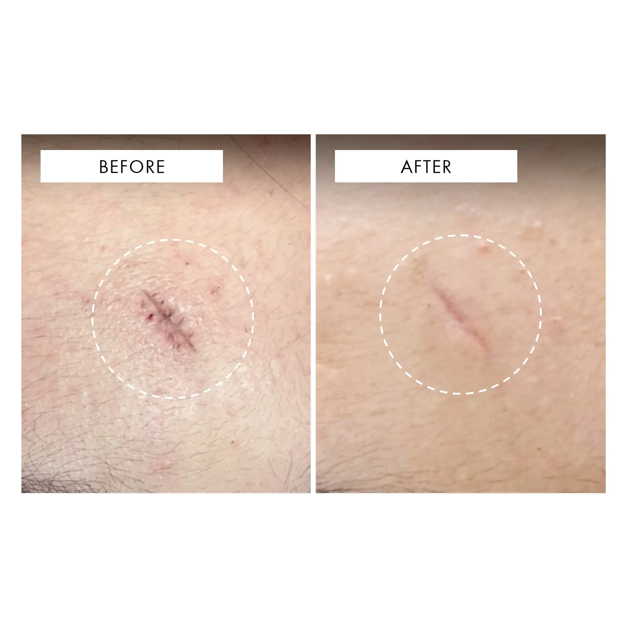 REPAIR SERUM NAC Y2